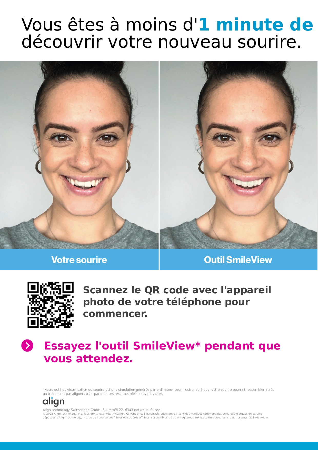 Avant Apres Invisalign casablanca maroc